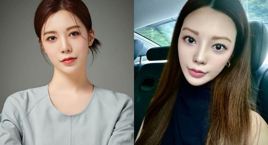 Lizzy Denies Plastic Surgery Rumors, Blames It on a Filter